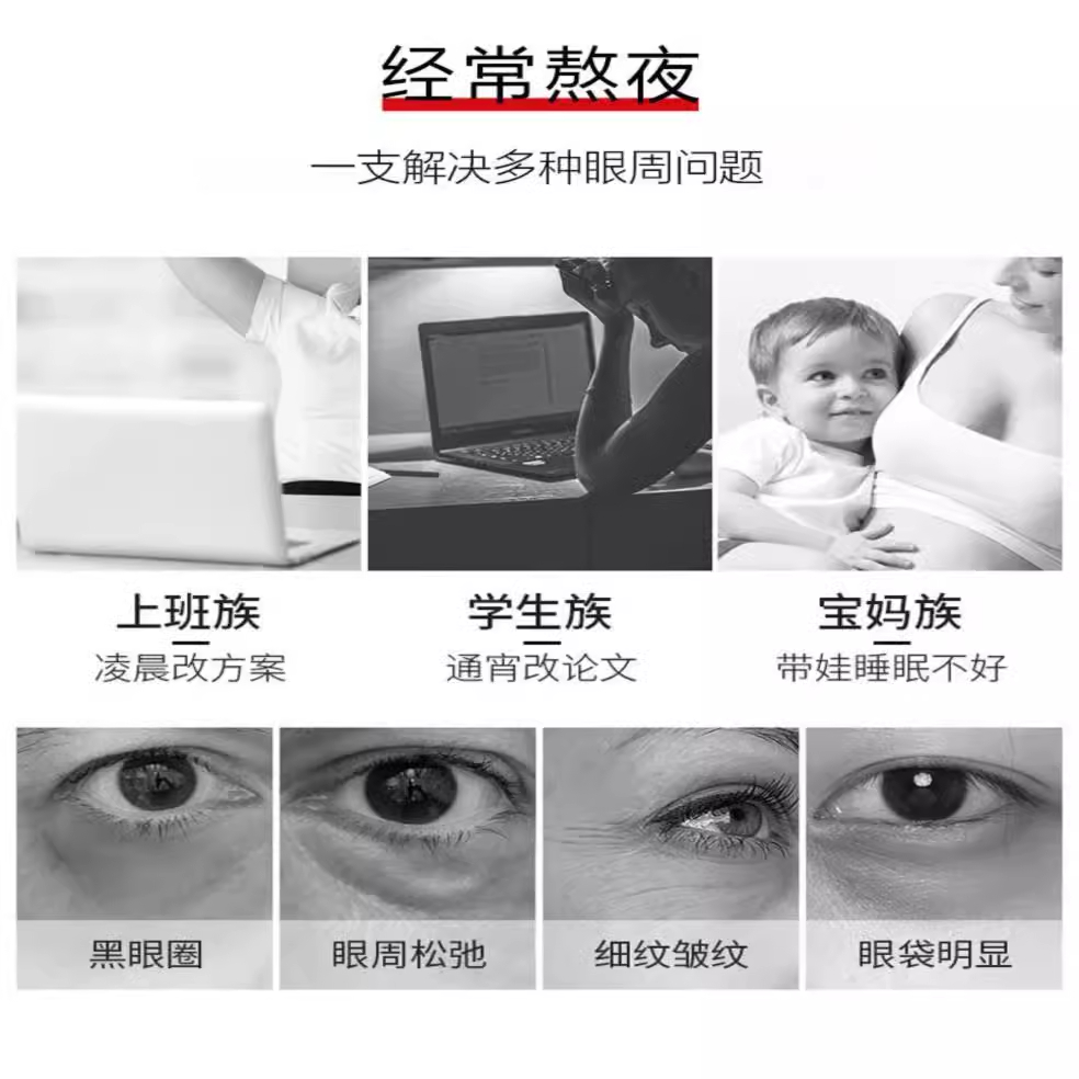 ULY眼部抗皱按摩精华油紧致淡化细纹眼袋黑眼圈滚珠官方旗舰店正 - 图0