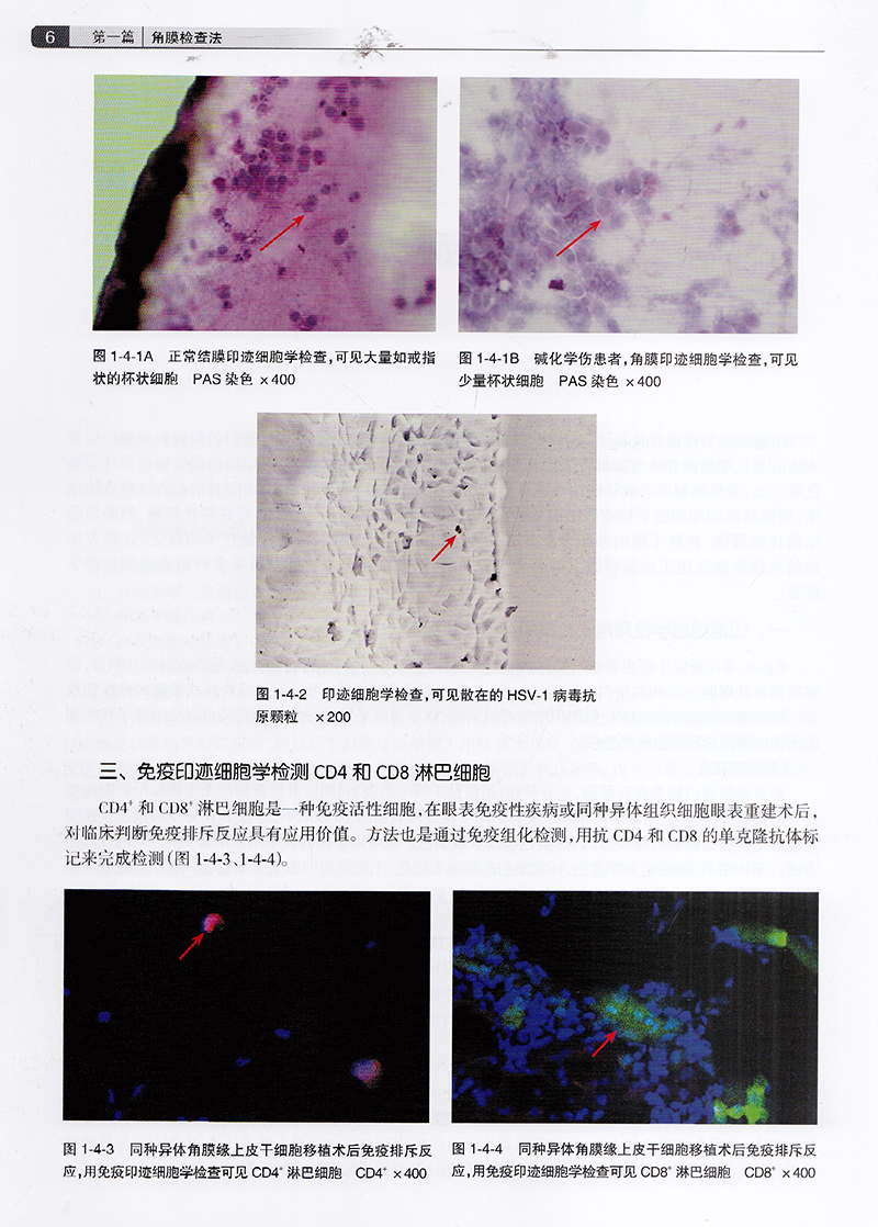 正版全新现货精装 临床角膜病学 谢立信人民卫生出版社9787117181945 - 图2