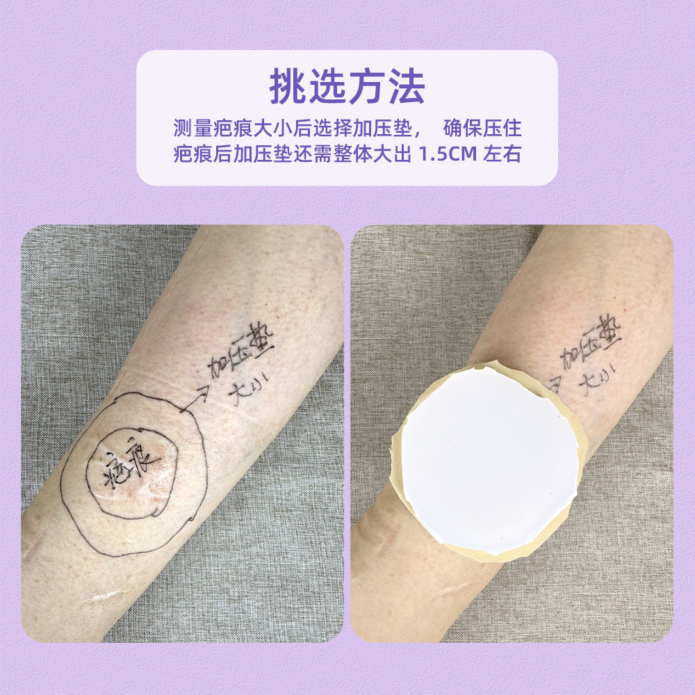 疤痕加压垫硅胶垫防疤痕增生儿童烧烫伤术后植皮加压平疤疤痕软垫,淘宝优惠券,粉丝福利购,淘宝优惠卷