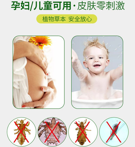 虱立净阴虱儿童头发喷剂虱子药祛除灭除头虱子一扫光大人小女孩 - 图2