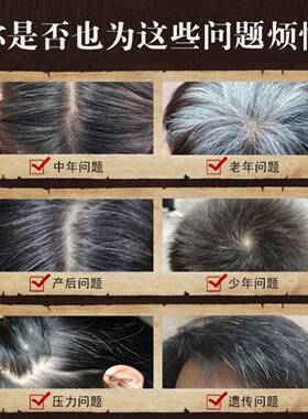 非遗何首乌养发经络梳