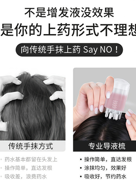 米诺头皮上药器大容量滚珠涂抹仪