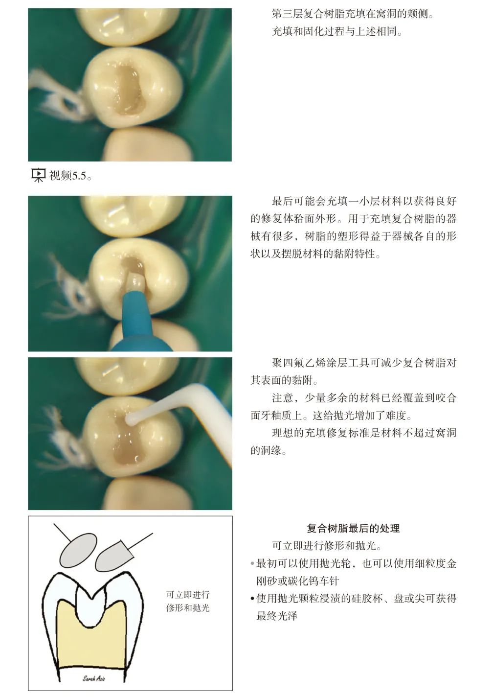 现货速发 实用牙体修复临床操作指南牙体修复冠部充填修复修复根管牙周种植临床牙医口腔医生薛晶阙克华主译辽宁科学技术出版社 - 图2