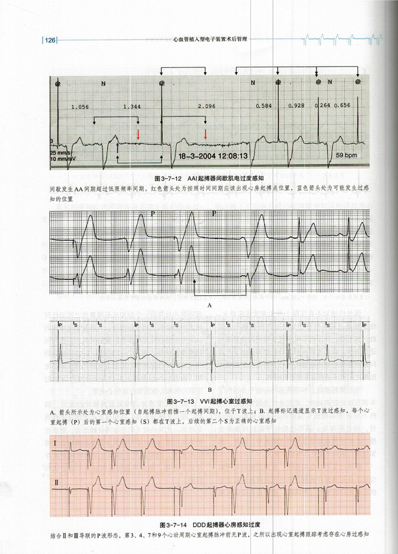 现货 心血管植入型电子装置术后处理 宿燕岗 秦胜梅主编 上海科学技术出版社