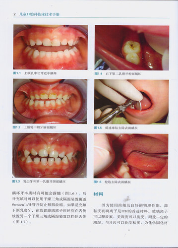 现货 儿童口腔科临床技术手册 辽宁科学技术出版社 - 图3
