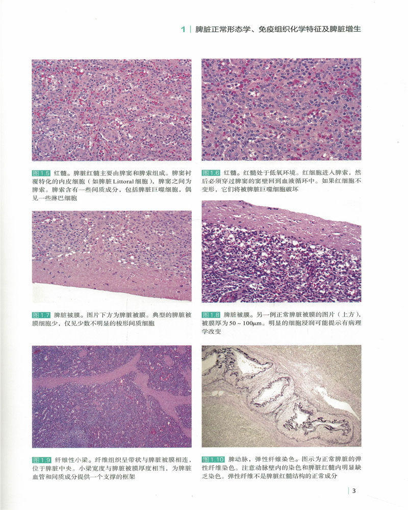 现货(美)丹尼斯北京脾脏病理学图谱 希尔麦图书医学图谱