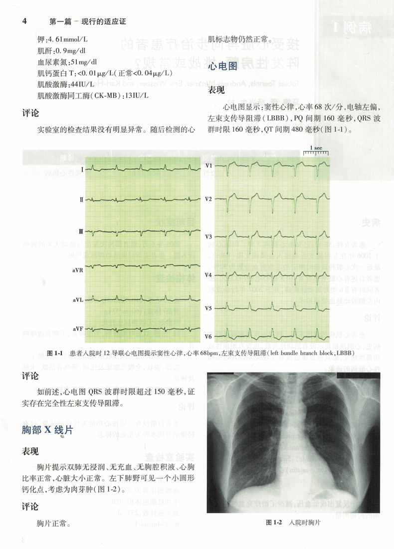 现货 心脏再同步化治疗病例分析(翻译版)余卓文主编 人民卫生出版社 - 图3