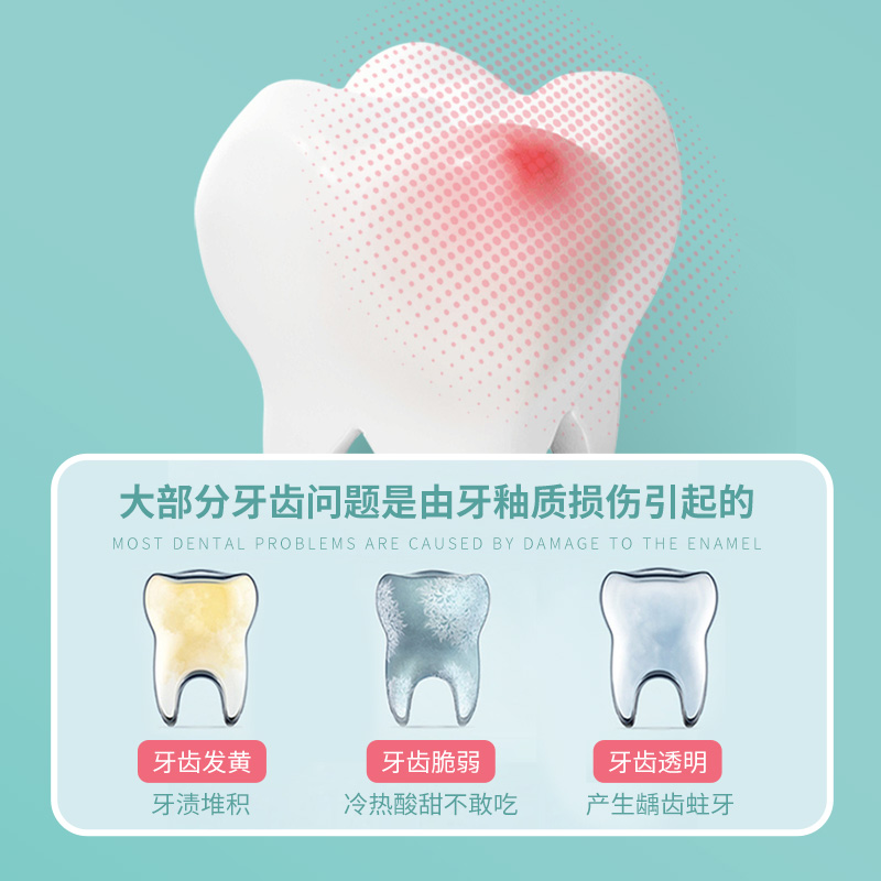 优牙合ph7牙膏含氟防蛀成人正畸孕产妇蛀牙专用薄荷清新口气固齿 - 图2