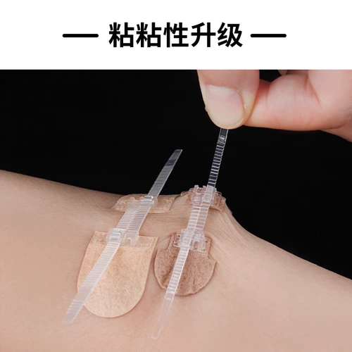 Shirui Medical Redtuce Red Scar Device Device Бесплатно сшивать наклейки на режущие наклейки на молнию