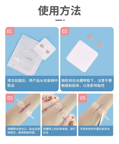 Shirui Medical Redtuce Red Scar Device Device Бесплатно сшивать наклейки на режущие наклейки на молнию