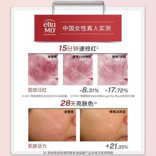 [Новый продукт маленького черного ящика] Eltamd Anyanke Sunscreen Чувствительный кожный проект освежающий изоляционный микрон щит 48g