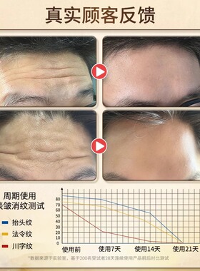 抬头纹细纹消除神器去除男士专用