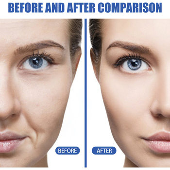 Blue Copper Peptide Anti-wrinkle Essence Desalinization