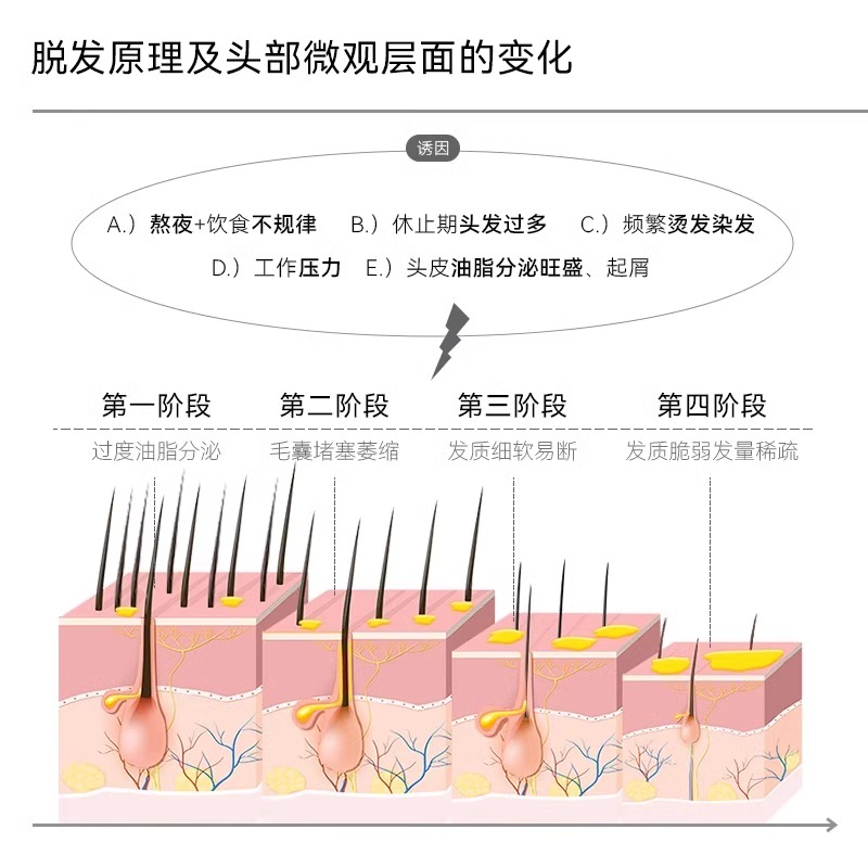 男女防脱发洗发水侧柏叶洗头膏露辉影植物防脱去屑去油哈恩旗舰店 - 图0