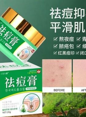 三花九露祛痘膏20g青春痘粉刺青少年脸上痘痘学生闭口暗疮祛痘膏