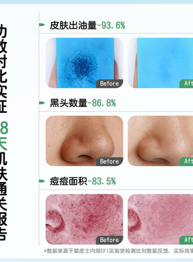 蒙度士曼度柠净洗面奶控油祛痘青少年男士专用去黑头清爽洁面乳