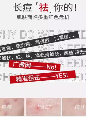 壬二酸凝胶去乳膏霜痘印斑黑色素