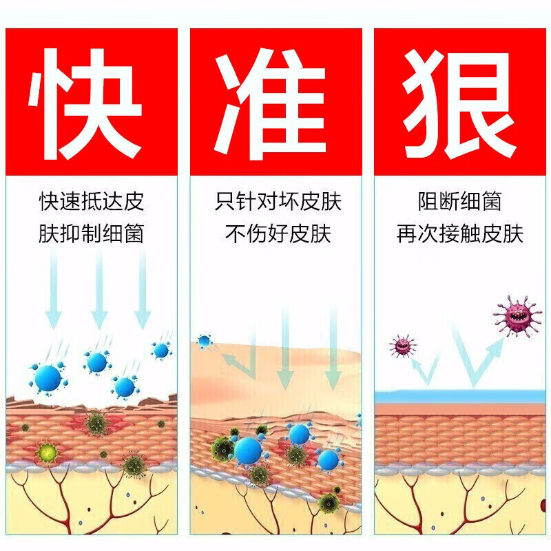 足癣脚癣一次净官方旗舰店药膏真菌感染js脚气泡脚脱皮止痒烂脚丫-图1