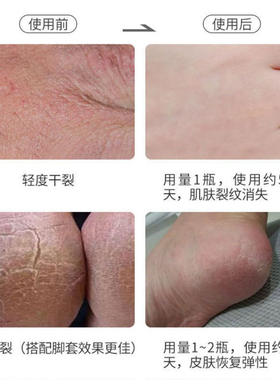 ALICEVA小绿瓶防裂滋润足霜