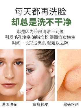埃及皂后黑皂天然深层清洁