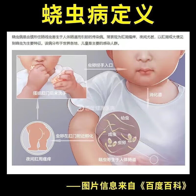 肠虫清中美史克小孩吃的打虫药成年人宝塔糖伊维菌素片人用yp6-图0