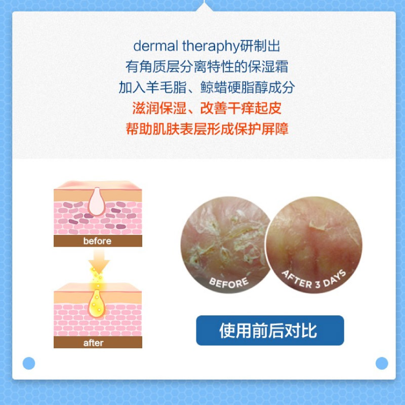 Dermal Therapy乐慕康护肤霜锁水保湿滋润改善干燥润肤乳身体乳女 - 图2