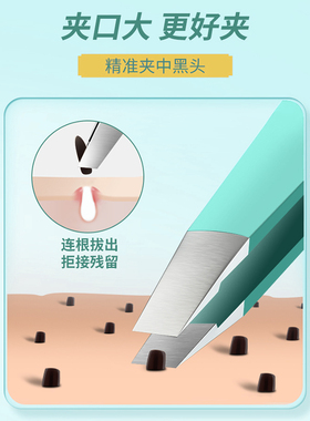 细胞夹黑头超细医用粉刺夹毳毛镊子拔毛高精密黑头铲祛痘工具套装