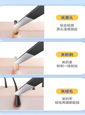 细胞夹去黑头镊子毳毛平头钳