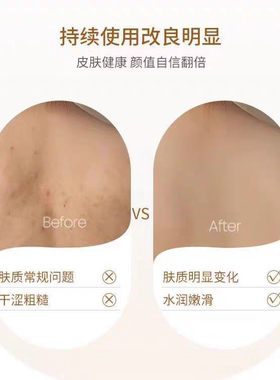 白兰花持久留香止痒沐浴露