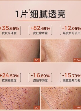 伊能静同款！肌侣光子油敷膜面膜