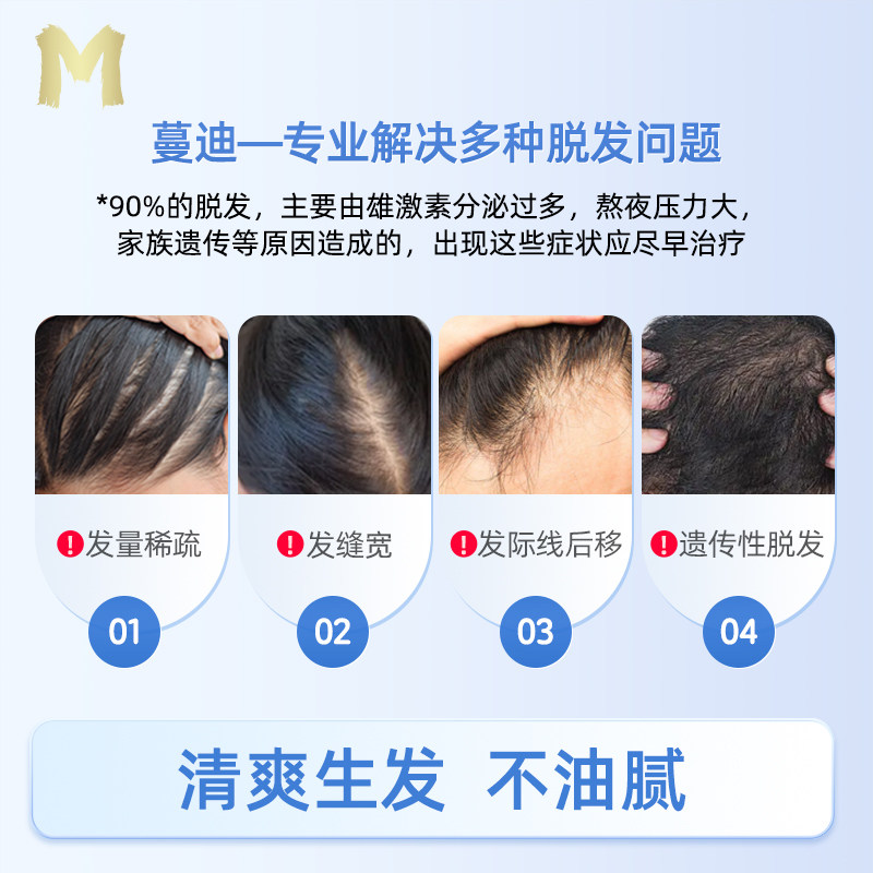 蔓迪米诺地尔酊生发液女性防脱发育发上药神器官方正品非2%精华剂_虎窝淘