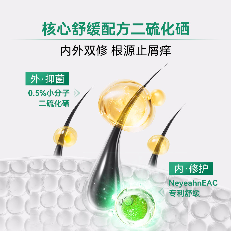 蔓迪二硫化硒去屑洗发水控油止痒洗发液洗头水0.5%不伤头皮非洗剂