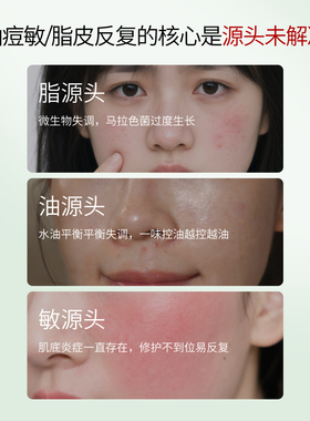 专利钙肽速修油痘敏重建水油平衡