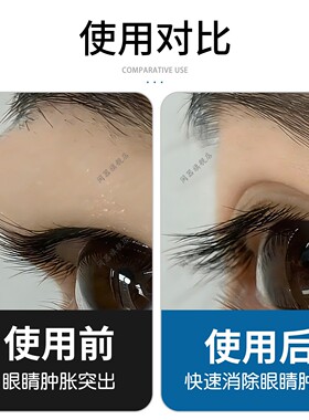 肿眼泡消肿神器上眼皮下垂提拉紧致隐形无痕眼贴改善水肿眼皮贴