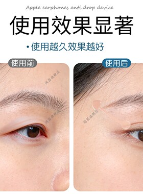 眼角下垂提拉贴法令纹胶带改善眼角额头贴抬头纹脸部防下垂神器