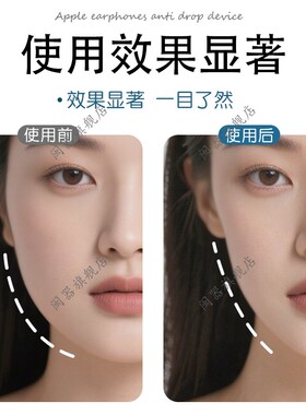 瘦脸贴法令纹川字纹面部提拉小v脸贴拉皮隐形胶带透明贴耳cos神器