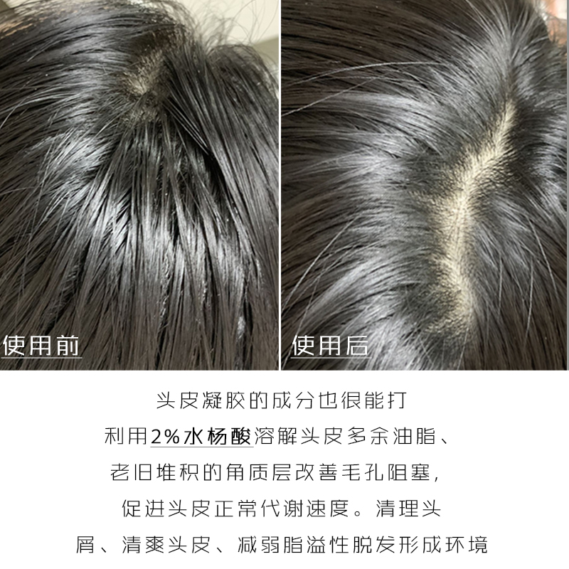 KIMTRUE且初头皮凝露护理止痒去屑控油毛囊深层清洁KT洗发凝胶5支