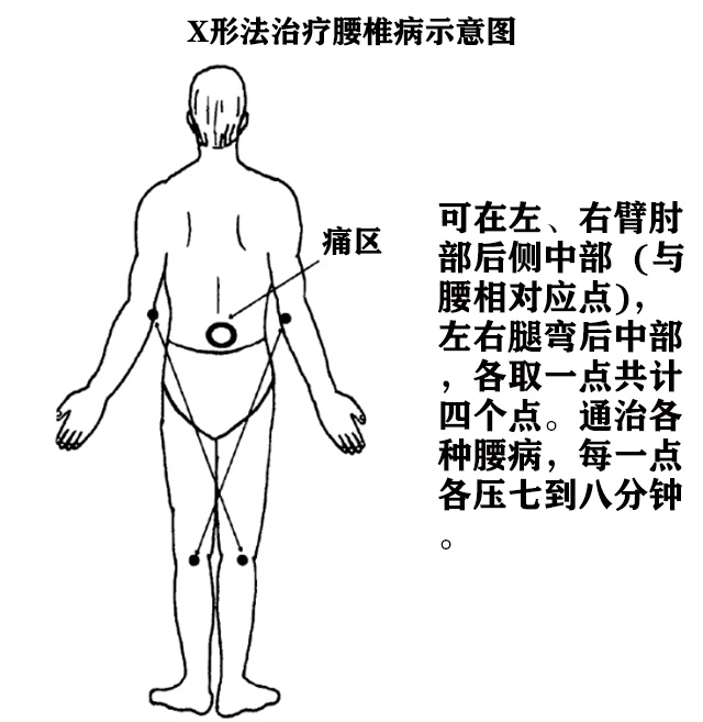 超大号穴位夹不伤经络疏通腰椎间盘突出疼痛理疗臻岐足三里按摩器 - 图2