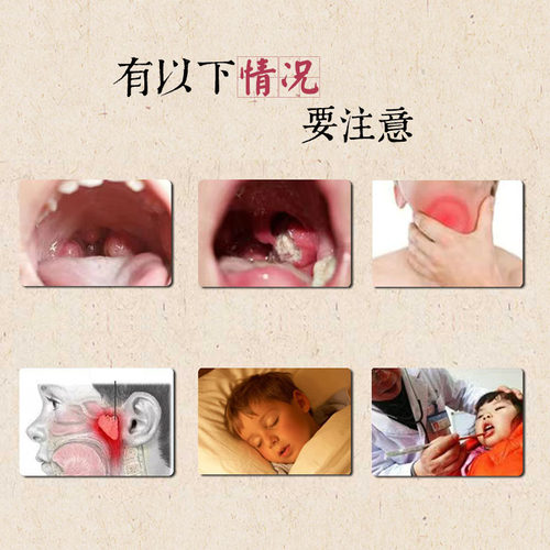 小儿宝宝咽扁贴嗓子异物贴喉咙不舒服疼扁桃体腺样咽喉扁桃贴 - 图1