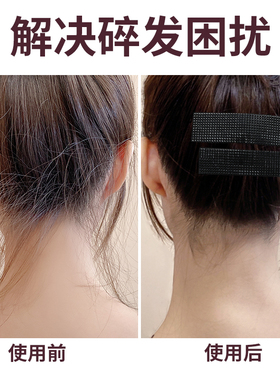 碎发夹后脑勺整理神器发卡女夏季