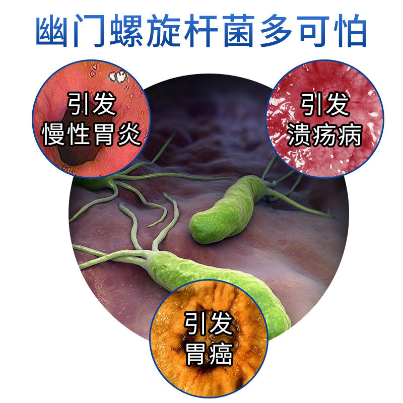 爱威康胃幽门螺旋杆菌检测试纸卡胃病胃炎口臭hp测试纸幽门螺杆菌_虎窝淘