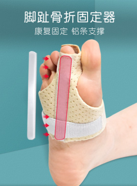 大小脚趾骨折固定器脚趾矫正器