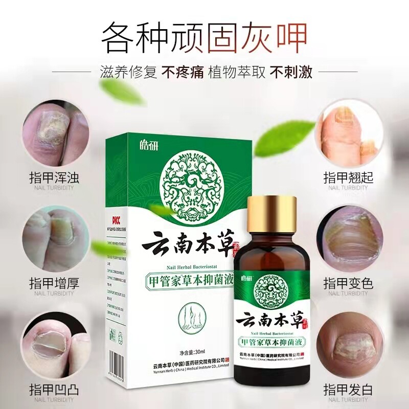 云南本草灰指甲抑菌液修甲刀脱甲膏 三客保健品保健理疗