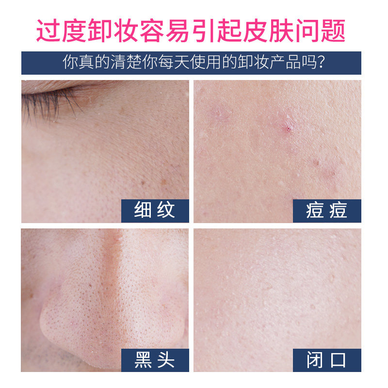 尔木萄氨基酸脸部温和清洁脸卸妆水 慕恩化妆品卸妆