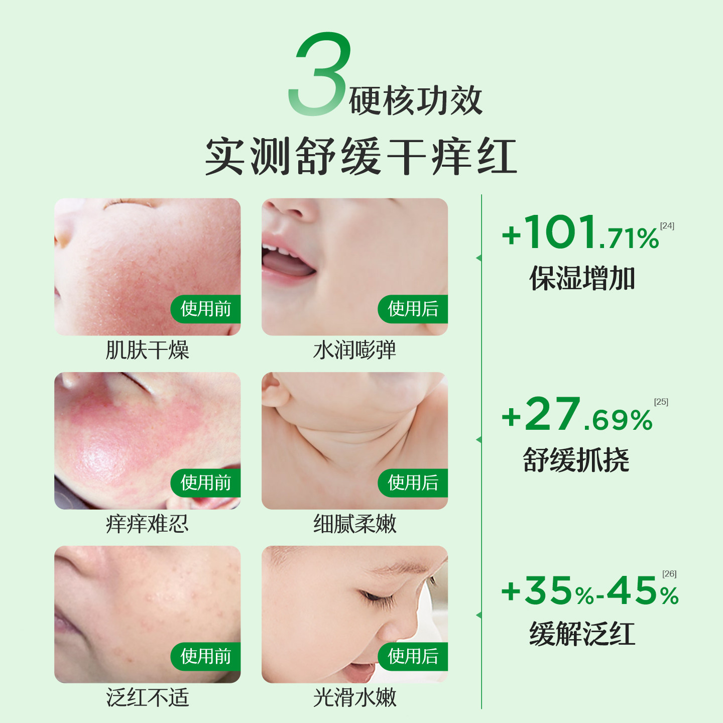 松达婴儿山茶油面霜儿童擦脸霜宝宝滋润补水多效保湿护肤霜50g 松达婴儿山茶油面霜儿童擦脸霜宝宝滋润补水多效保湿护肤霜50g