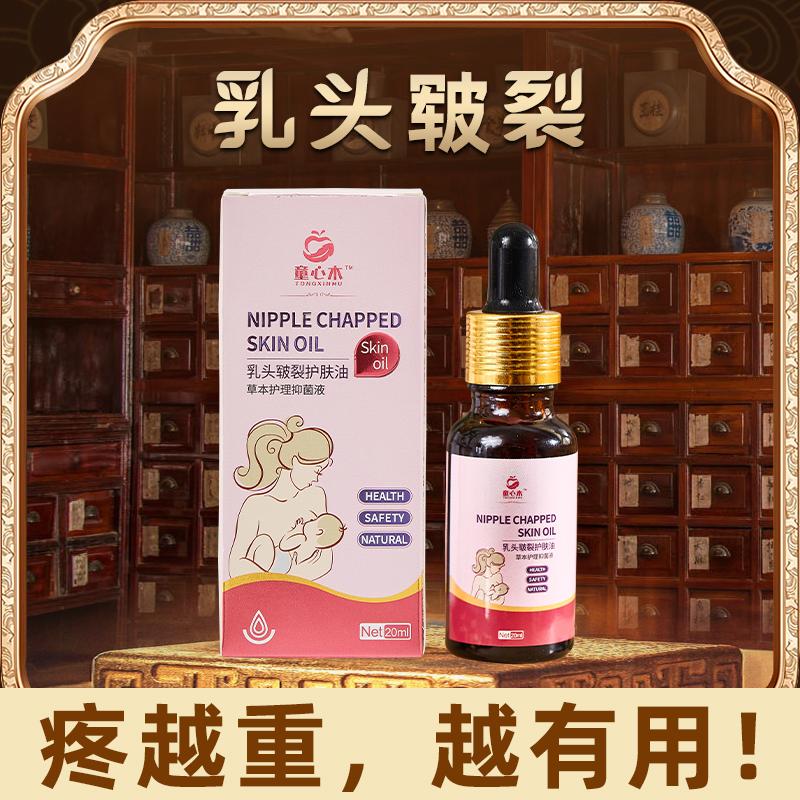 童心木乳头油皲裂油哺乳期喂奶疼哺乳痛羊脂膏裂口红肿发炎护理霜-图2