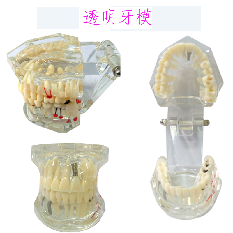 牙齿模型模具早教刷牙牙模标准教具幼儿园教刷牙儿童宝宝口腔教学-图3