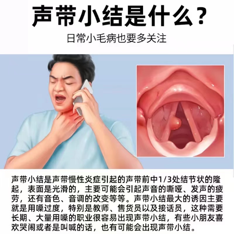 嗓子哑声音嘶哑咽喉肿痛喉咙发炎声带息肉小结滤泡增生搭修复贴YY-图0