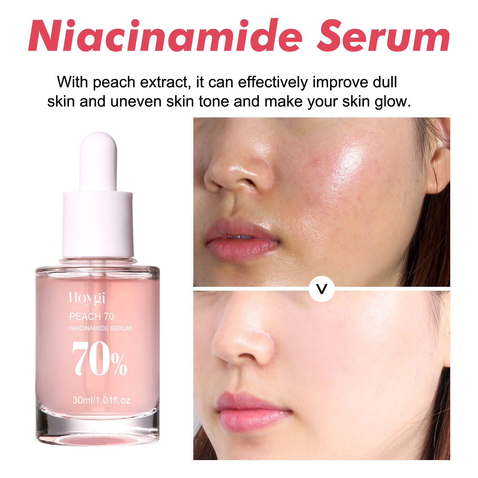 Hoygi Niacinamide Essence Firming And Moisturizing Pore - 图2