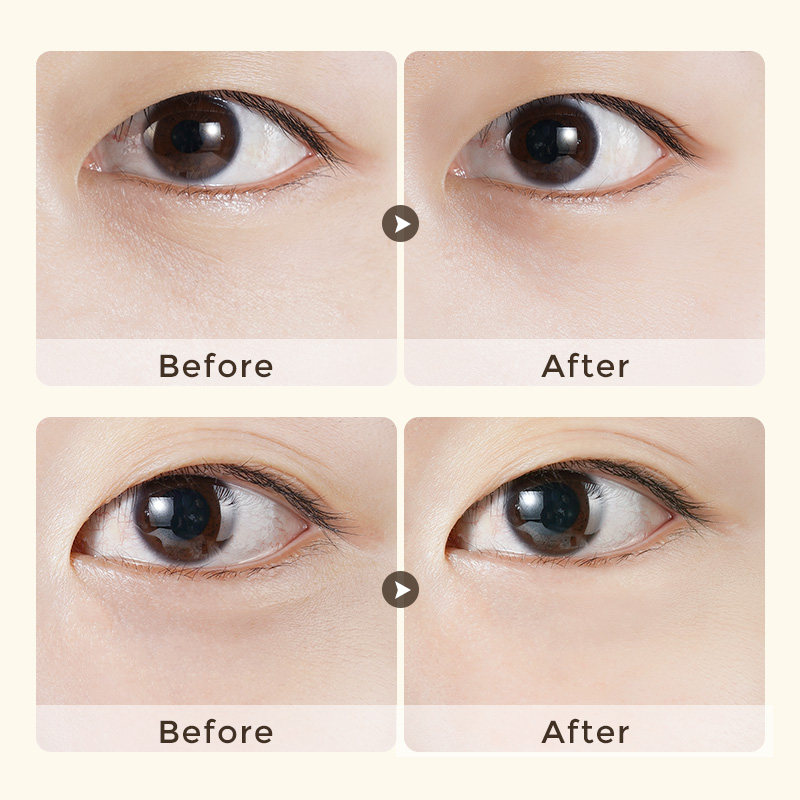 辛有志微萃鱼子精华眼部精华液改善 辛有志专属店眼霜